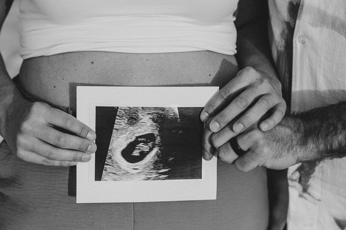 Black and white close-up of parents-to-be holding an ultrasound print against the baby bump